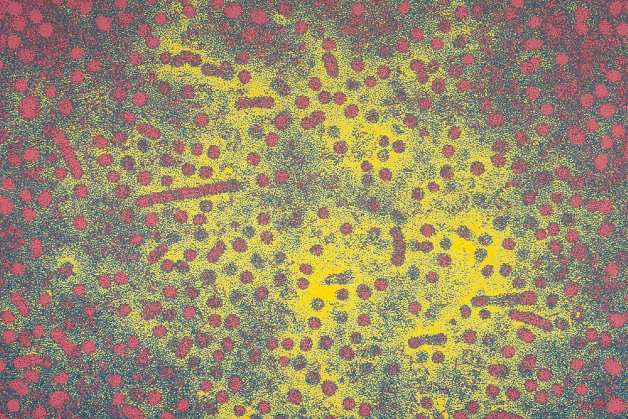 Hbv гепатит. Вирусный гепатит под микроскопом. Вирус гепатита микрофотография. Электронная микрофотография вируса гепатита b. Вирус гепатита под микроскопом.