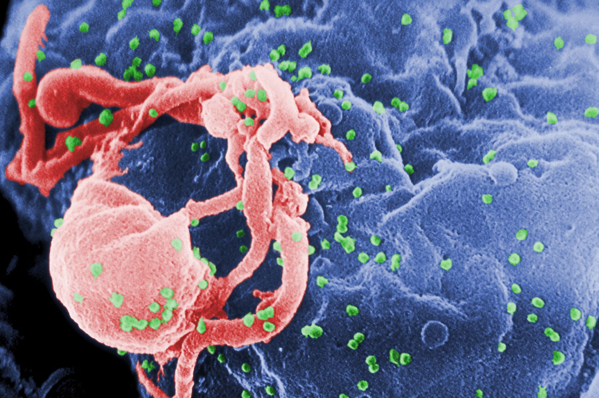 Merck Halts Dosing In Phase II HIV-1 Combination Therapy Trial