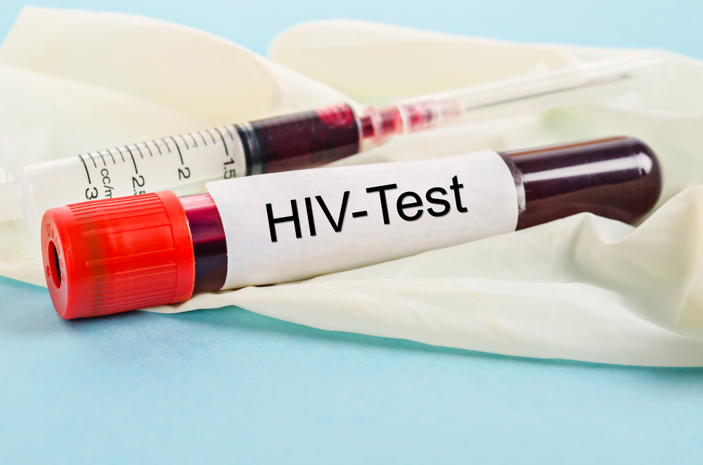 Opt-out testing in England will help early diagnosis of HIV